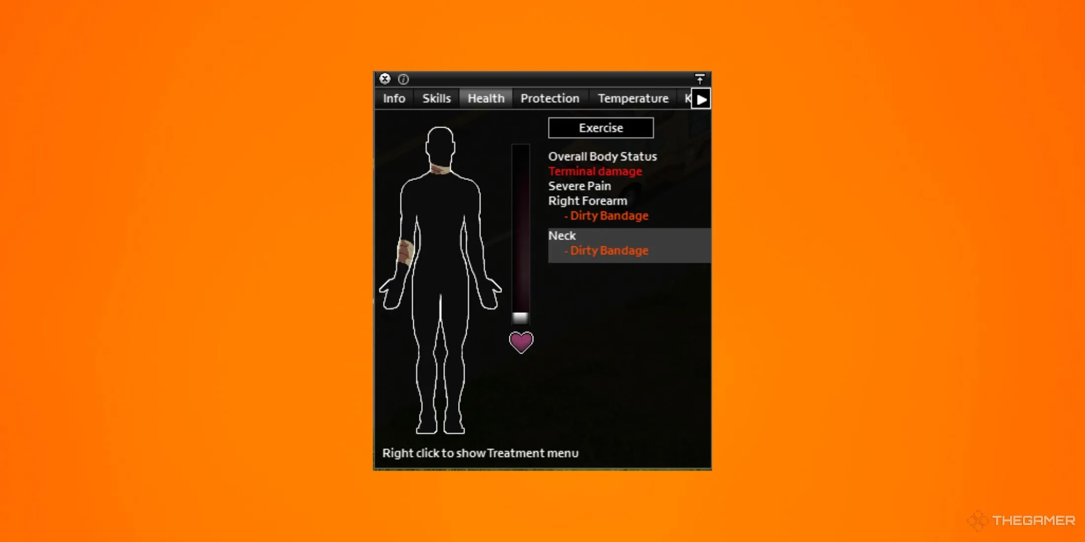 Màn hình nhân vật bị thương và menu điều trị trong game sinh tồn Project Zomboid.